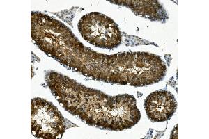 IHC analysis of IFT88 using anti-IFT88 antibody (ABIN7600458).