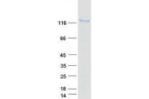 Validation with Western Blot