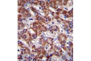 Immunohistochemistry analysis in formalin fixed and paraffin embedded human liver tissue reacted with OR2B11 Antibody (C-term) followed which was peroxidase conjugated to the secondary antibody and followed by DAB staining. (OR2B11 anticorps  (C-Term))