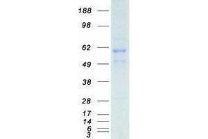 Validation with Western Blot