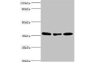 Western blot All lanes: MDH1 antibody at 4 μg/mL Lane 1: HepG2 whole cell lysate Lane 2: Hela whole cell lysate Lane 3: Mouse kidney tissue Secondary Goat polyclonal to rabbit IgG at 1/10000 dilution Predicted band size: 37, 28, 39 kDa Observed band size: 37 kDa (MDH1 anticorps  (AA 1-334))