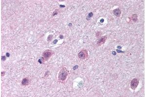 Human Brain, Cortex (formalin-fixed, paraffin-embedded) stained with IPO9 antibody ABIN297232 at 10 ug/ml followed by biotinylated goat anti-rabbit IgG secondary antibody ABIN481713, alkaline phosphatase-streptavidin and chromogen. (Importin 9 anticorps  (AA 950-1000))