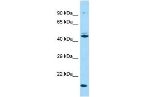 Western Blotting (WB) image for anti-Outer Dense Fiber of Sperm Tails 3 (ODF3) (N-Term) antibody (ABIN2790487) (ODF3 anticorps  (N-Term))