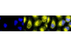 Immunocytochemistry/Immunofluorescence analysis using Rabbit Anti-PDI Polyclonal Antibody (ABIN361828 and ABIN361829).