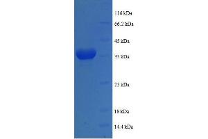 SDS-PAGE (SDS) image for Cytochrome C Oxidase Subunit VIa Polypeptide 1 (COX6A1) (AA 25-109), (full length) protein (GST tag) (ABIN618776)