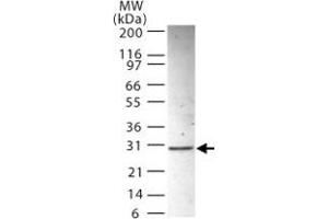Western blot analysis of ANP32B in HL-60 whole cell lysate using ANP32B polyclonal antibody  at 2 ug/mL . (ANP32B anticorps  (AA 1-17))