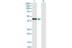 Western Blot analysis of SNAPC2 expression in transfected 293T cell line by SNAPC2 monoclonal antibody (M01), clone 4B8. (SNAPC2 anticorps  (AA 16-114))