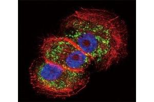 Confocal immunofluorescent analysis of Parkin antibody with NCI-H460 cells followed by Alexa Fluor 488-conjugated goat anti-rabbit lgG (green).