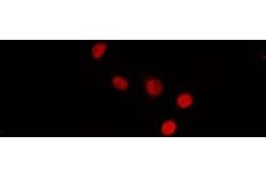 ABIN6272431 staining MCF7 by IF/ICC.