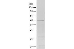 Western Blotting (WB) image for Cyclin A2 (CCNA2) (AA 268-432) protein (His-IF2DI Tag) (ABIN7122518)