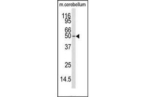 Western blot analysis of anti-CKK1 Antibody (N-term) (ABIN392189 and ABIN2841895) in mouse cerebellum tissue lysates (35 μg/lane).