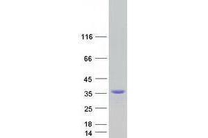 Validation with Western Blot
