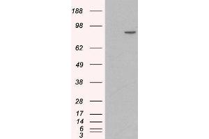 Western Blotting (WB) image for Catenin (Cadherin-Associated Protein), alpha 1, 102kDa (CTNNA1) peptide (ABIN369355)