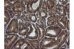 Immunohistochemistry (IHC) image for anti-Formiminotransferase Cyclodeaminase (FTCD) antibody (ABIN1496380)