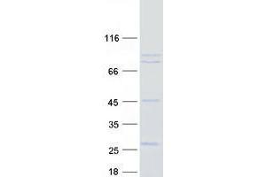 Validation with Western Blot (USP44 Protein (Transcript Variant 2) (Myc-DYKDDDDK Tag))