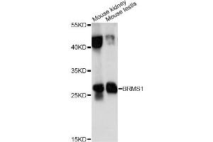 Western blot analysis of extracts of various cell lines, using BRMS1 antibody (ABIN6290118) at 1:1000 dilution.