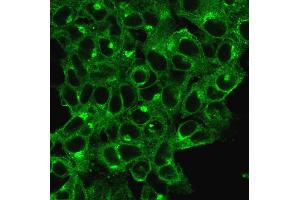 Immunofluorescent staining of HeLa cells.