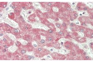 Detection of IFNb in Human Liver Tissue using Polyclonal Antibody to Interferon Beta (IFNb)