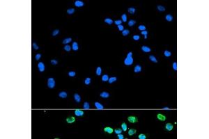 Immunofluorescence analysis of HeLa cells using IRF5 Polyclonal Antibody (IRF5 anticorps)