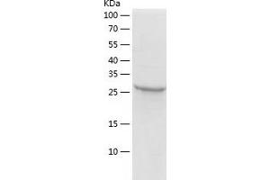 Western Blotting (WB) image for Zinc Finger Protein 518A (ZNF518A) (AA 495-780) protein (His tag) (ABIN7125794) (ZNF518A Protein (AA 495-780) (His tag))