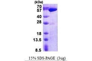 Figure annotation denotes ug of protein loaded and % gel used. (USP14 Protéine)