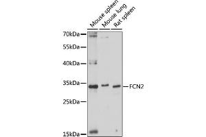 Western blot analysis of extracts of various cell lines, using FCN2 antibody (ABIN7267201) at 1:1000 dilution. (Ficolin 2 anticorps  (AA 230-290))