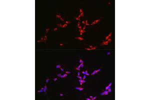 Immunofluorescence analysis of SH-SY5Y cells using Glutaminase (GLS) antibody (ABIN1680034, ABIN3018235, ABIN3018236 and ABIN6220412) at dilution of 1:150.