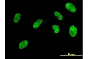 Immunofluorescence of monoclonal antibody to NHLH2 on HeLa cell. (NHLH2 anticorps  (AA 36-135))