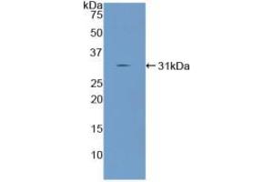Western blot analysis of recombinant Mouse ANGPTL2.