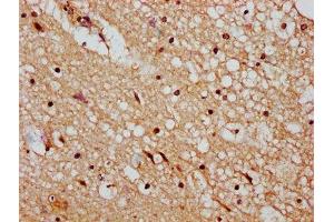 IHC image of ABIN7150197 diluted at 1:400 and staining in paraffin-embedded human brain tissue performed on a Leica BondTM system.