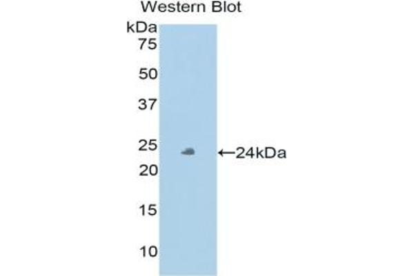 Peroxidasin antibody  (AA 76-260)