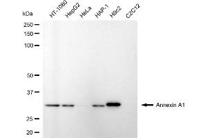 Western blotting analysis using annexin A1 antibody (ABIN7797611).
