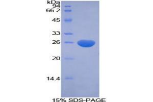 SDS-PAGE analysis of Human CFC1 Protein. (CFC1 Protéine)