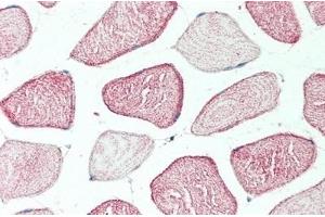 Detection of MERTK in Human Skeletal Muscle Tissue using Polyclonal Antibody to C-Mer Proto Oncogene Tyrosine Kinase (MERTK) (MERTK anticorps  (AA 587-858))