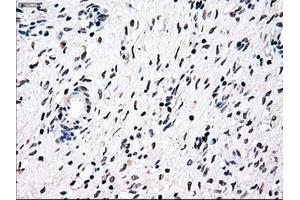 Immunohistochemical staining of paraffin-embedded Ovary tissue using anti-NRBP1mouse monoclonal antibody. (NRBP1 anticorps)