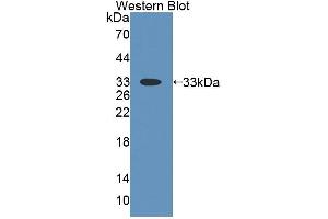 Western blot analysis of the recombinant protein. (THYN1 anticorps  (AA 1-226))