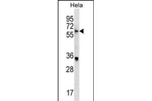 KLH22 Antibody (C-term) (ABIN1537487 and ABIN2849661) western blot analysis in Hela cell line lysates (35 μg/lane). (KLHL22 anticorps  (C-Term))