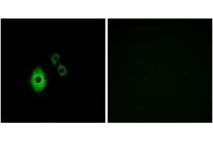 Immunofluorescence analysis of A549 cells, using KCNJ5 Antibody. (KCNJ5 anticorps  (AA 370-419))