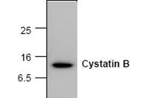 Western Blotting (WB) image for anti-Cystatin B (Stefin B) (CSTB) antibody (ABIN126940) (CSTB anticorps)