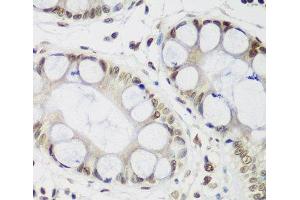 Immunohistochemistry of paraffin-embedded Human gastric using CBX3 Polyclonal Antibody at dilution of 1:200 (40x lens). (CBX3 anticorps)
