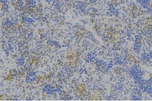 ABIN6278017 at 1/100 staining Human lymph node tissue by IHC-P. (Neuropilin 1 anticorps)