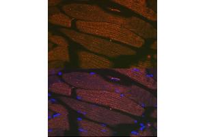Immunofluorescence analysis of mouse bone marrow cells using SERC/ Rabbit mAb (9639) at dilution of 1:100 (40x lens). (ATP2A1/SERCA1 anticorps)