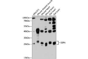 Western blot analysis of extracts of various cell lines, using SSPN antibody (ABIN6132896, ABIN6148488, ABIN6148489 and ABIN6215784) at 1:3000 dilution. (SSPN anticorps  (AA 1-60))
