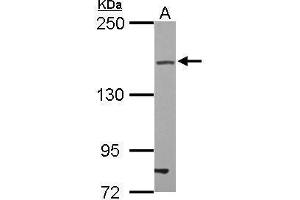 WB Image Sample (30 ug of whole cell lysate) A: U87-MG 5% SDS PAGE antibody diluted at 1:500 (TJP2 anticorps)