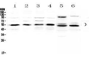Western blot analysis of RXRA using anti-RXRA antibody .