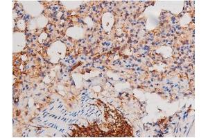 ABIN6267487 at 1/200 staining Mouse lung tissue sections by IHC-P. (alpha Adducin anticorps  (pSer726))