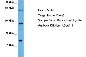 Host: Rabbit Target Name: FOXA3 Sample Tissue: Mouse Liver Antibody Dilution: 1ug/ml (FOXA3 anticorps  (C-Term))