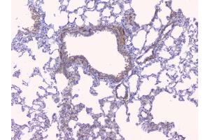 IHC analysis of Aromatase using anti-Aromatase antibody (ABIN6719449).