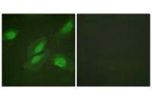 Immunofluorescence analysis of HeLa cells, using Akt (Ab-326) antibody. (AKT1 anticorps  (Tyr326))
