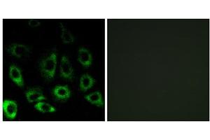 Immunofluorescence analysis of A549 cells, using MBTPS2 antibody. (MBTPS2 anticorps  (Internal Region))